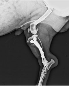 Fractura proximal 1